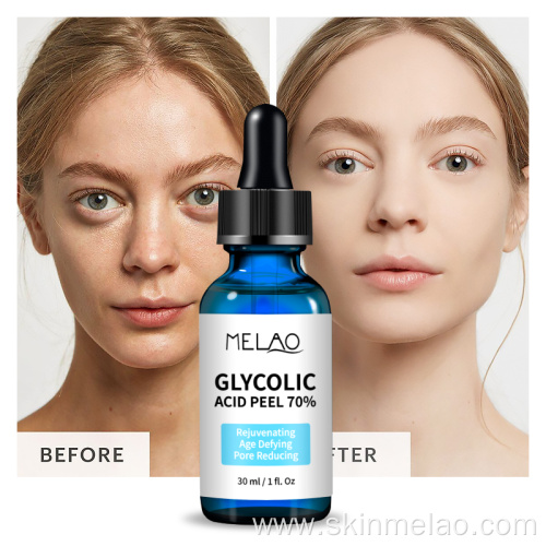 Glycolic Acid Peeling Serum